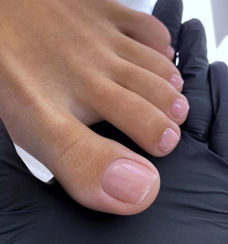 Here's Why You Should Never Ignore an Ingrown Toenail